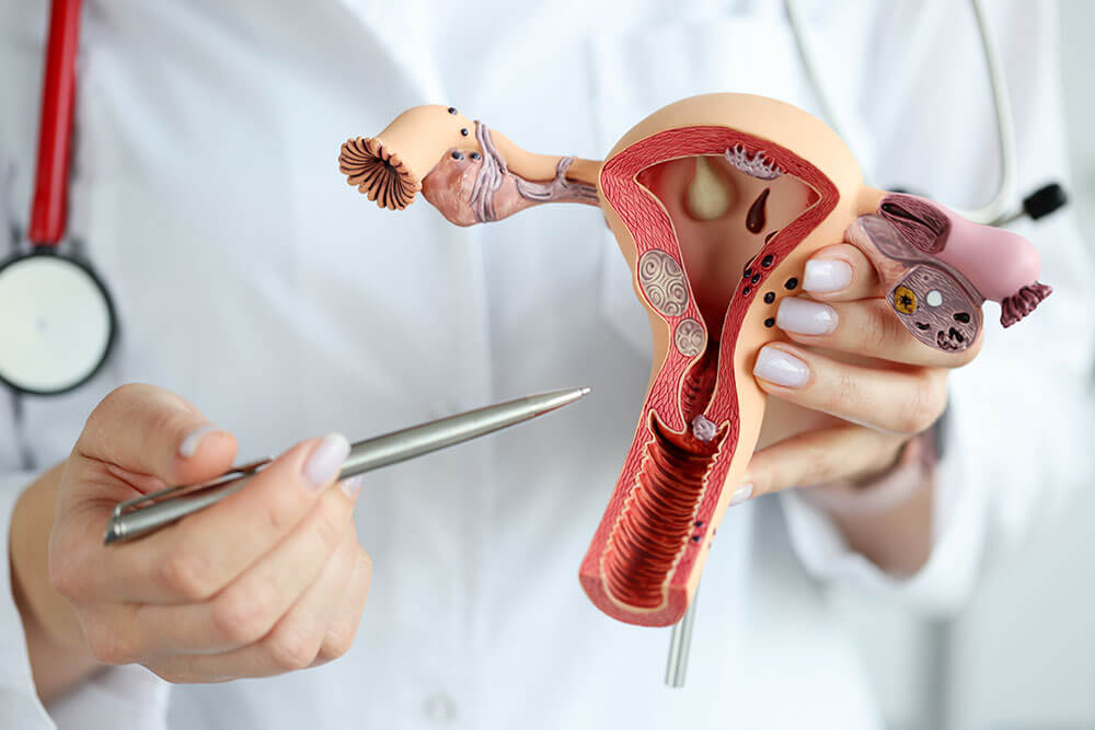 image pathologie gynécologie